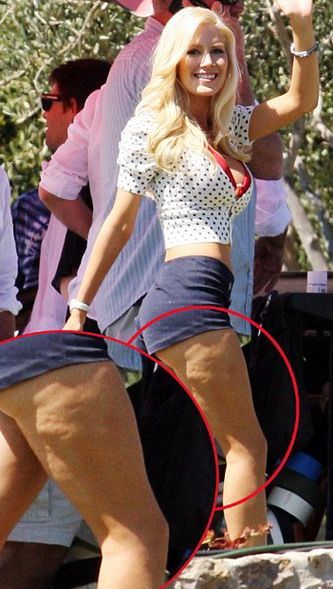 Chiar si cu 10 operatii estetice, Heidi Montag nu a scapat de celulita! FOTO!