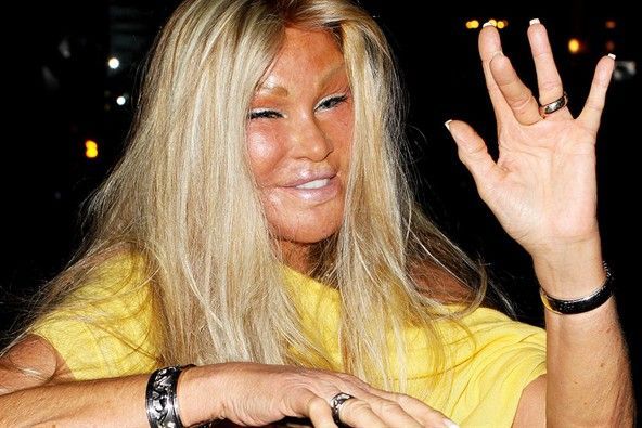 Cum au transformat-o operatiile estetice pe Jocelyn Wildenstein dintr-o femeie frumoasa in cea mai infricosatoare celebritate &nbsp;