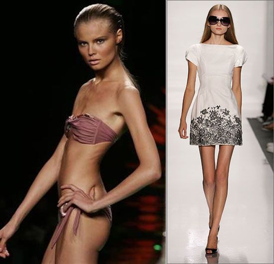 Au murit pe catwalk din cauza anorexiei. Modele care au fost invinse de anorexie