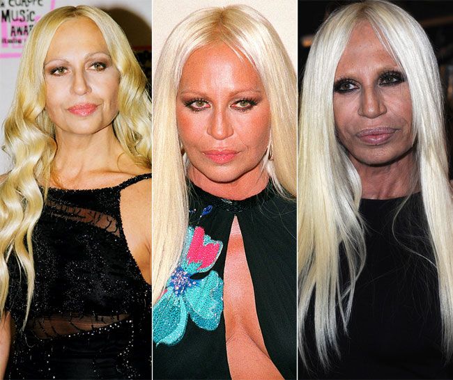 Cum s-a autodistrus Donatella Versace. De la o frumusete naturala, la un chip deformat de operatii estetice si bronz excesiv