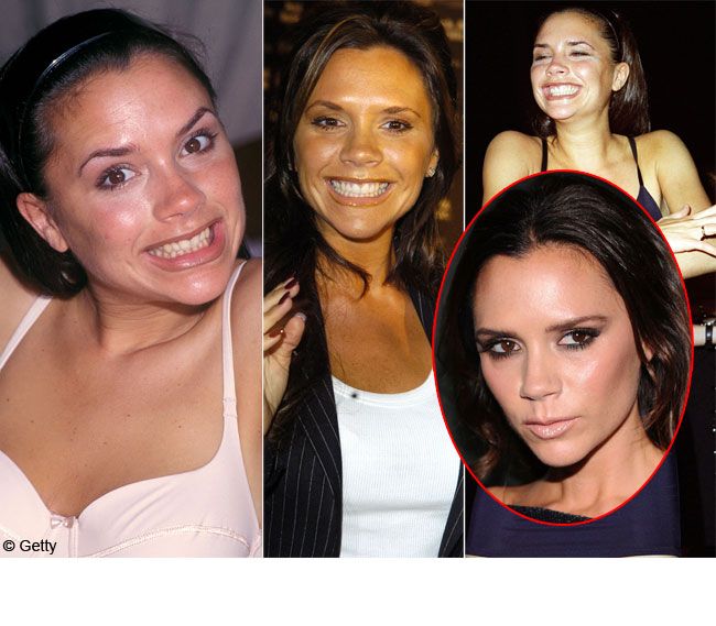 Victoria Beckham, pe vremea cand radea cu gura pana la urechi. Vezi de ce acum e disperata sa-si ascunda chipul&nbsp;