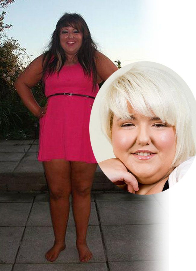 Tanorexia dusa la extrem. Vezi in ce hal a ajuns o tanara din Marea Britanie din cauza obsesiei pentru bronz