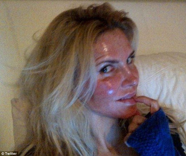 Era una dintre cele mai frumoase casnice de reality show din America. Cum si-a distrus fata Brandi Glanville din cauza unui tratament de infrumusetare