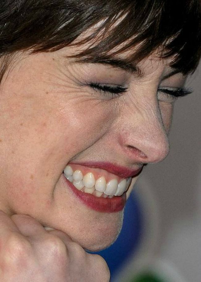 Cum arata vedetele de aproape: riduri, puncte negre si defecte vizibile