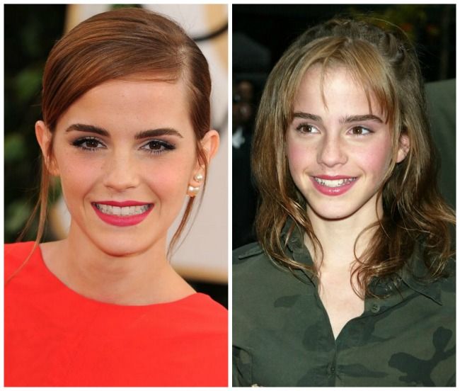 Era uratica si cu dintii strambi. Cum arata Emma Watson cand a debutat in actorie
