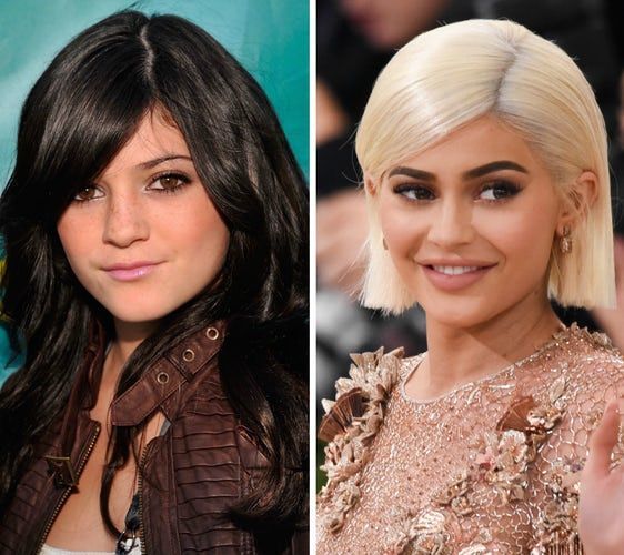 Khlo&eacute;, Kim, Kylie sau Kendall: cine are cele mai multe operații estetice? Verdictul chirurgilor plasticieni