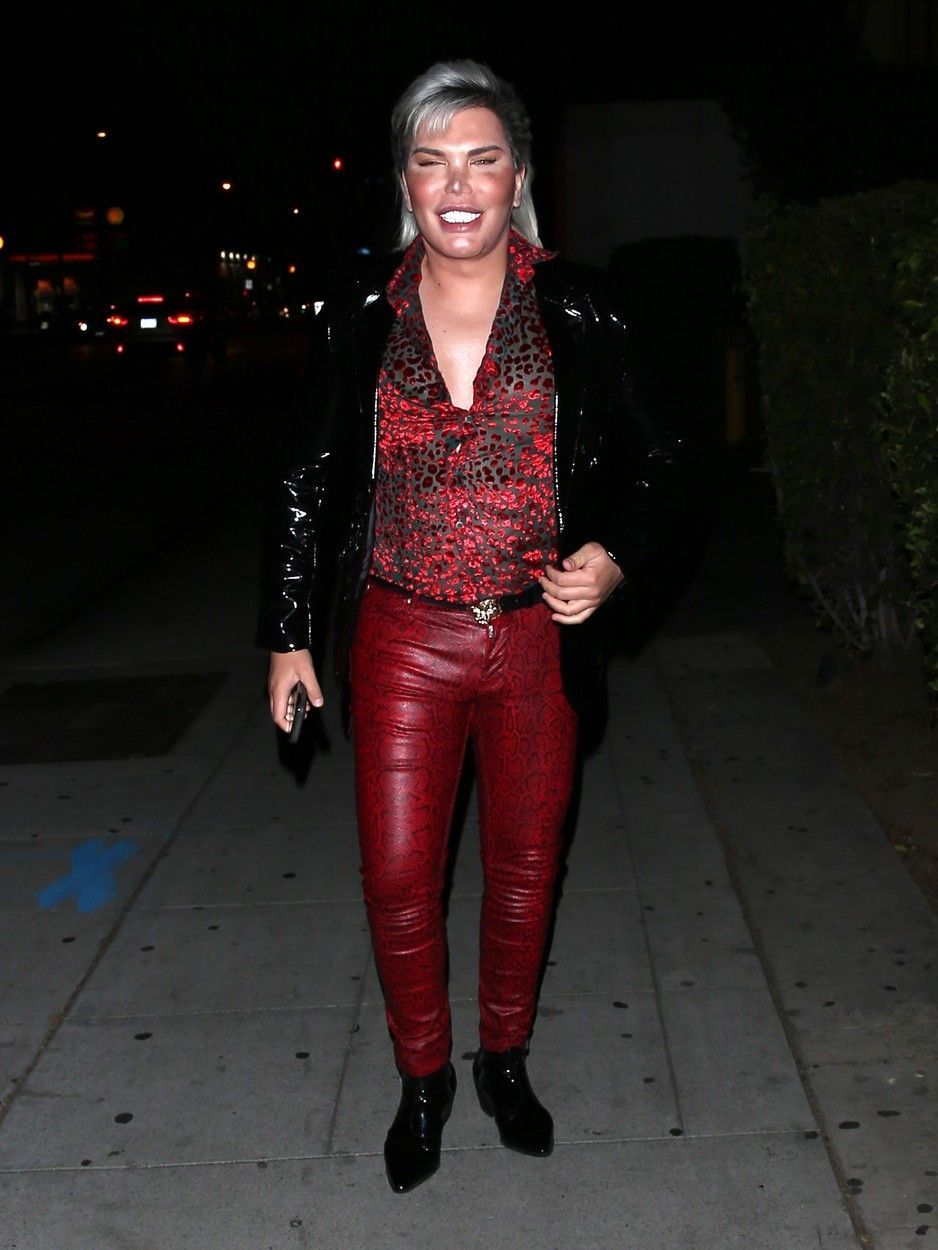 Rodrigo Alves, dezvăluire șocantă: după 11 rinoplastii, nasul său este complet distrus. Cum arată acum