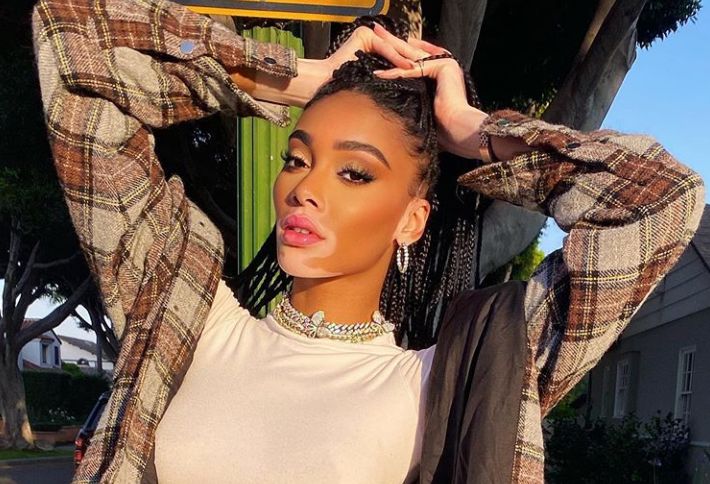 Nu se &icirc;nscrie &icirc;n tiparele obișnuite de frumusețe, dar este celebră &icirc;n toată lumea. Cine este noul iubit al lui Winnie Harlow