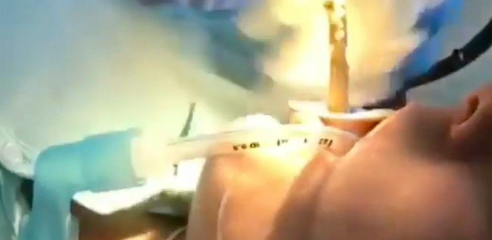 A dormit &icirc;n curtea casei, iar mai apoi s-a simțit rău și a mers la spital. Ce au scos medicii din burta acestei femei