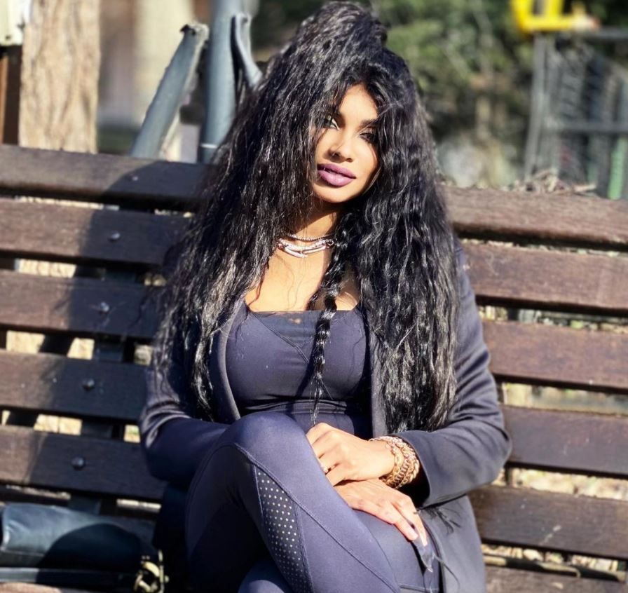 Laurette, nevoită să se opereze de urgență după bataia de la hotel. Cu ce probleme se confruntă vedeta