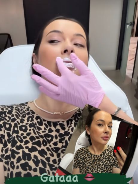 Vlăduța Lupău, din nou pe m&acirc;na medicului estetician! Artista s-a filmat chiar &icirc;n timpul intervenției