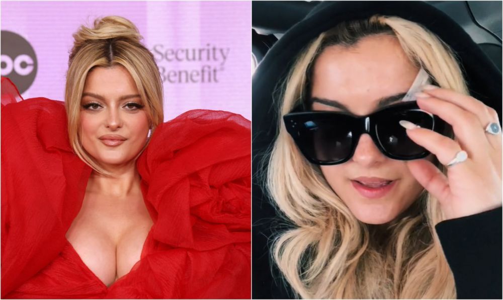 Cum arată chipul Bebei Rexha după ce a fost lovită &icirc;n față cu un telefon, &icirc;n timpul unui concert. Primele imagini cu c&acirc;ntăreața