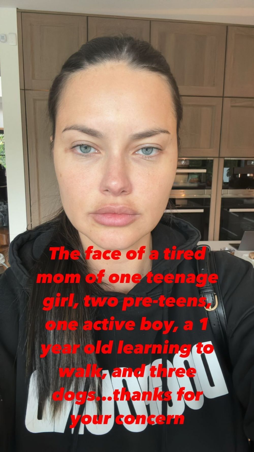 &ldquo;Nu pare aceeași persoană!&rdquo; Adriana Lima explică, &icirc;n sf&acirc;rșit, de ce arată at&acirc;t de diferit &icirc;n ultima vreme