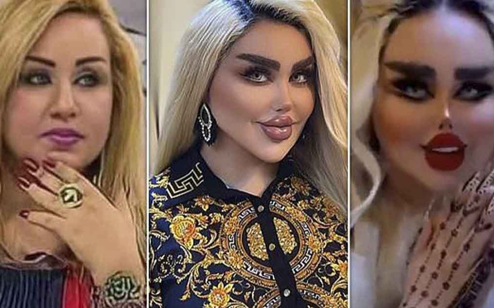 &ldquo;Am făcut 43 de operații ca să arat ca păpușa Barbie, dar lumea spune că semăn cu un zombie&rdquo;. Transformarea incredibilă a influenceriței